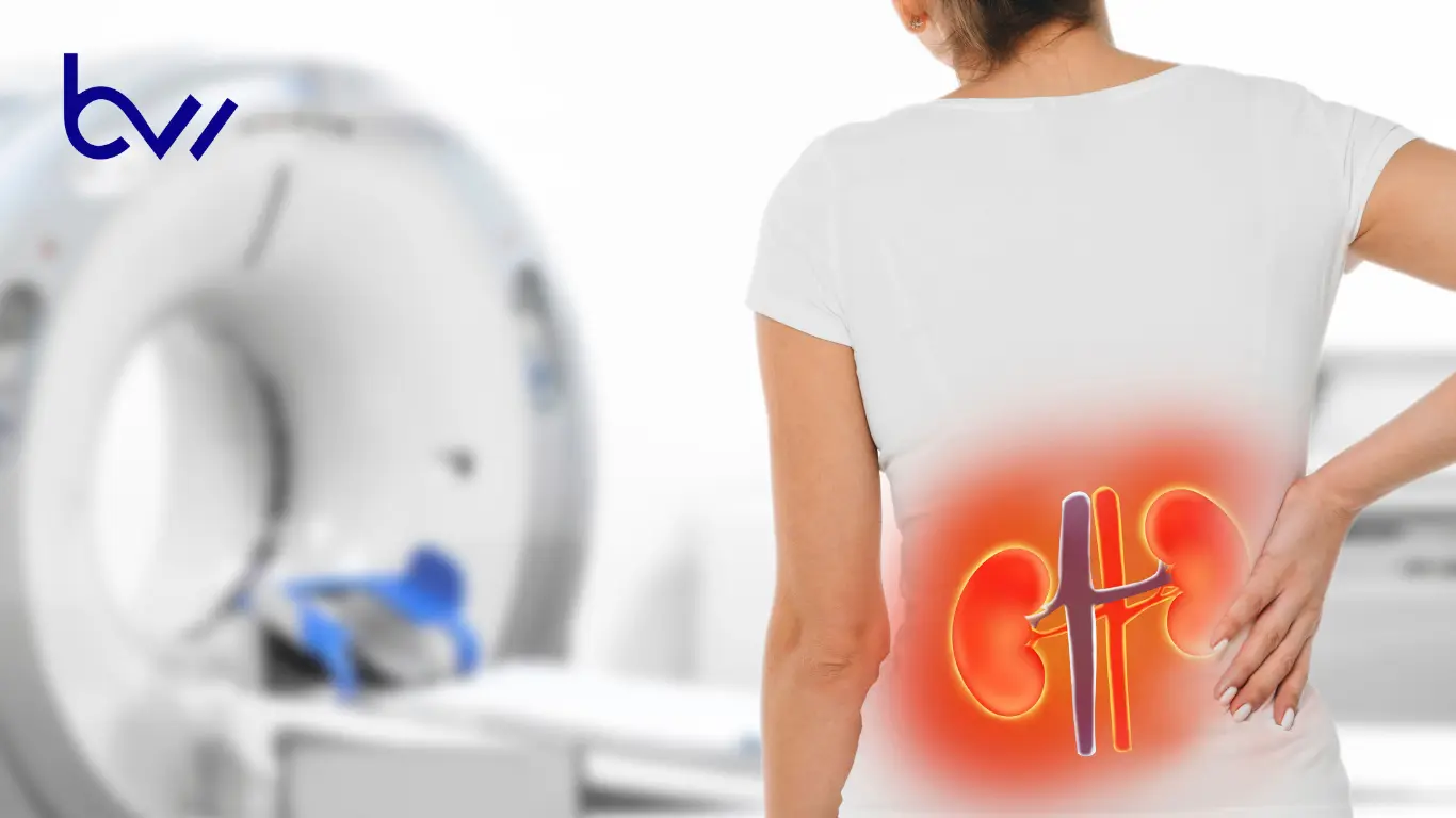 How Fast Can a Kidney Infection Kill You
