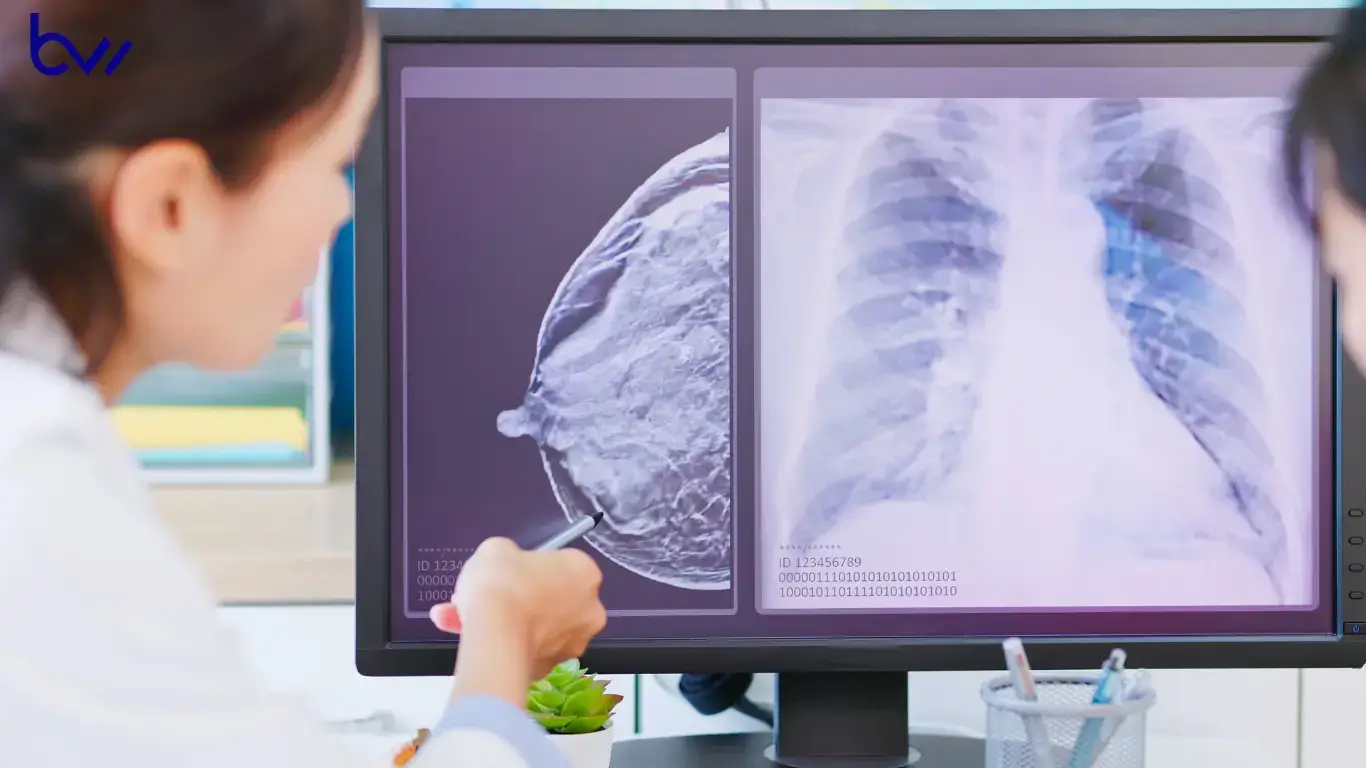 Colon Cancer Screening